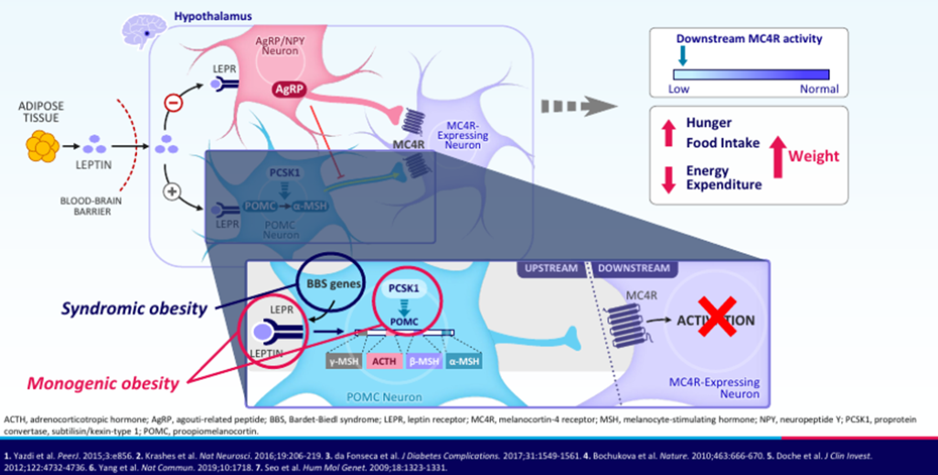 Rhythm Pharmaceuticals Figure 2 Impairment of the MC4R Signaling Pathway